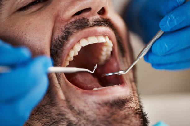 Best Emergency Broken Tooth Repair in Pu, HI